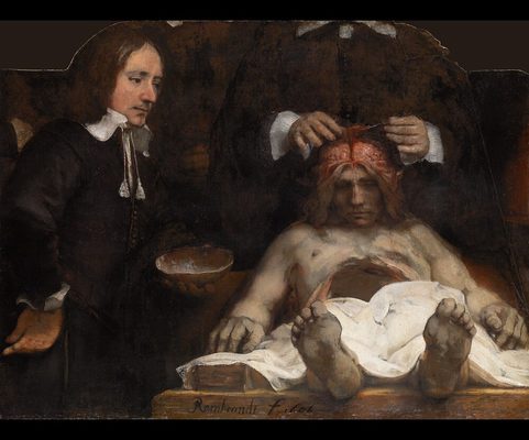 Anatomische les van Dr. Jan Deijman (fragment), 1656, Rembrandt